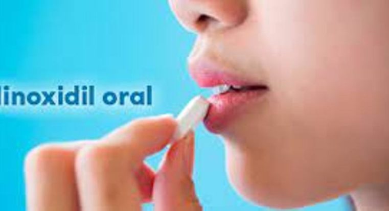 Calvice: Anvisa não recomenda tratamento com minoxidil por via oral