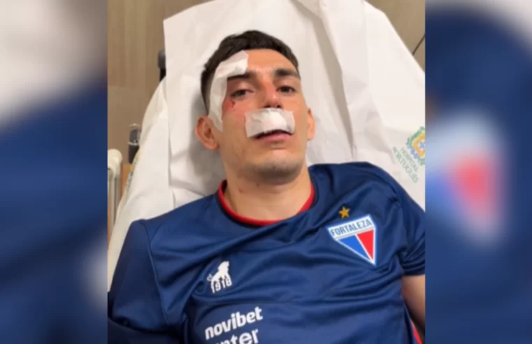 Ônibus do Fortaleza é atingido por bomba e jogadores são levados ao hospital