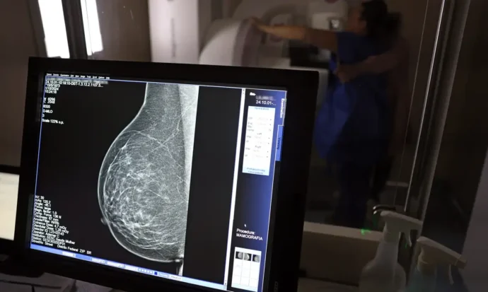 Outubro Rosa reforça diagnóstico precoce de câncer de mama