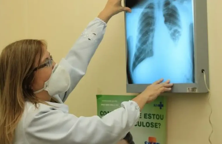 Dia Mundial de Combate à Tuberculose conscientiza sobre a prevenção