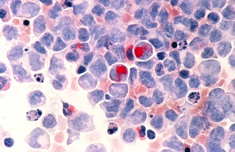 Fevereiro Laranja conscientiza sobre importância da doação de medula