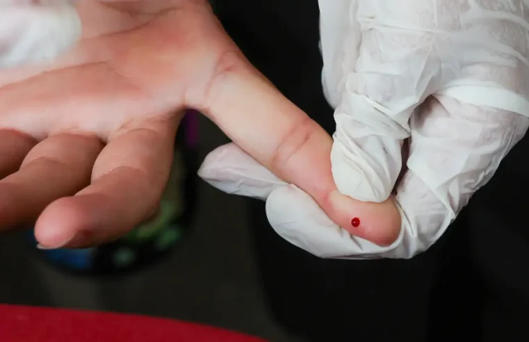 Teste rápido da dengue passa a integrar Tabela de Procedimentos do SUS